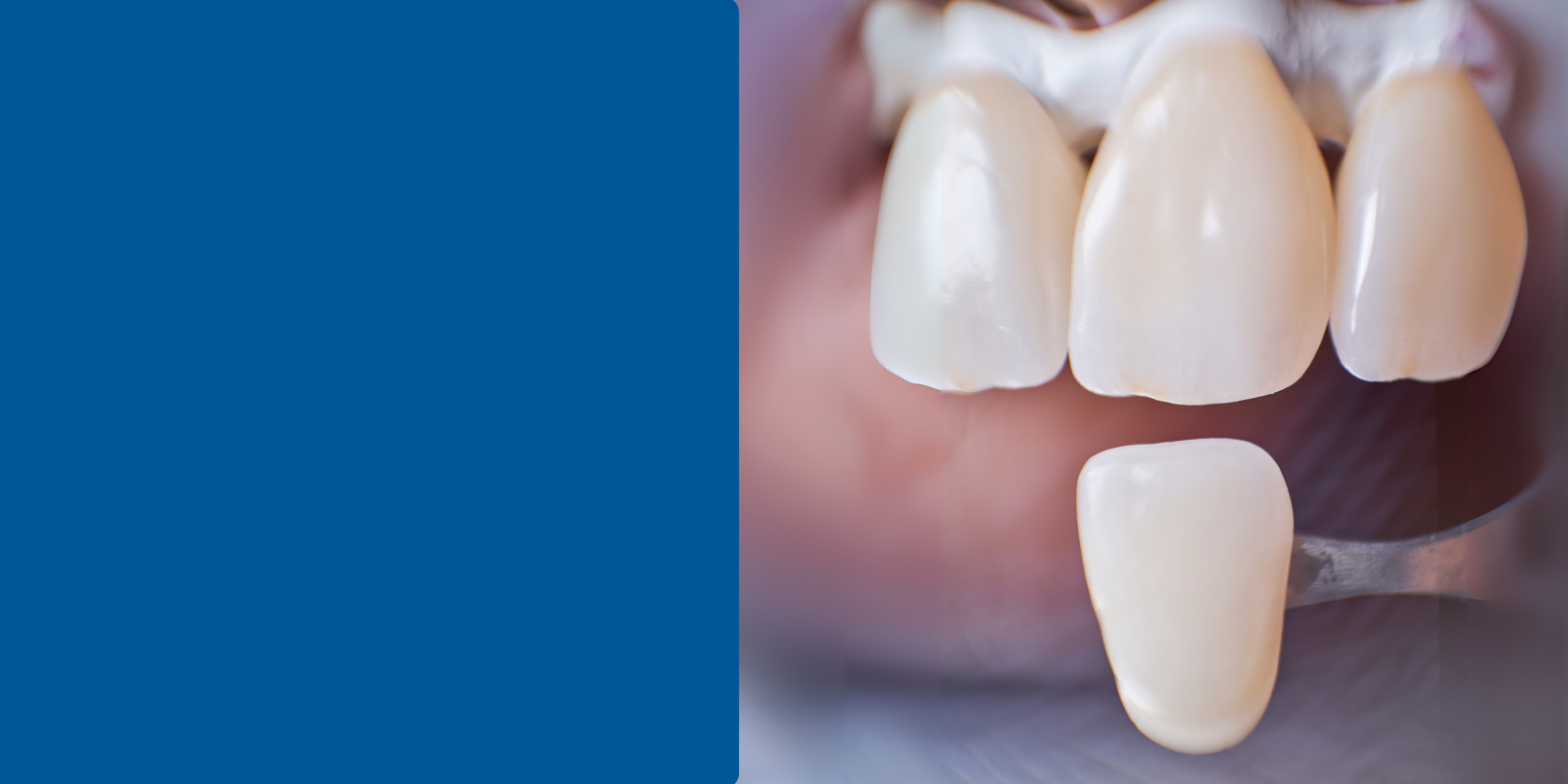 Study confirms: simplified layering, pleasing results