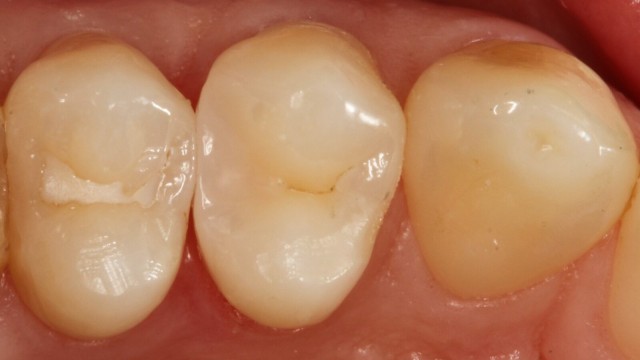 Venus Bulk Flow ONE
