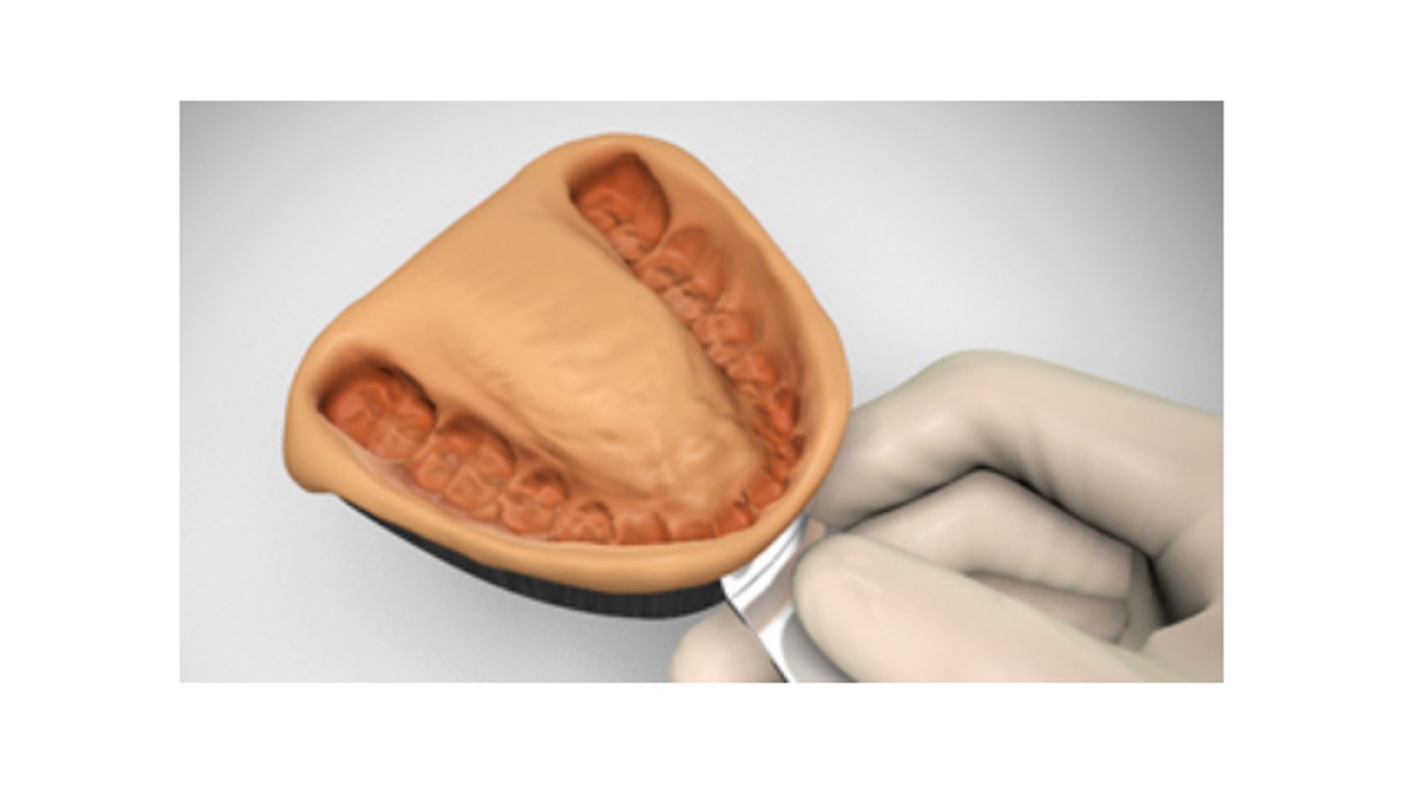 Alginate and Alginate Substitute Impression Materials