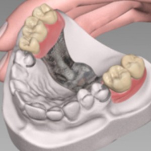 Denture Materials