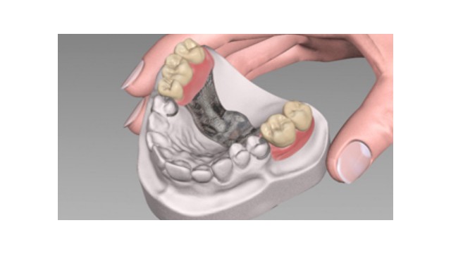 Denture Materials