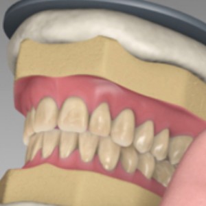 Denture Teeth