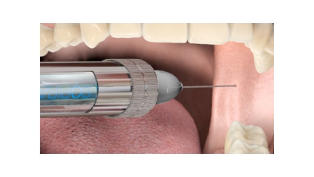 Infiltration- and Nerve Block Anaesthesia