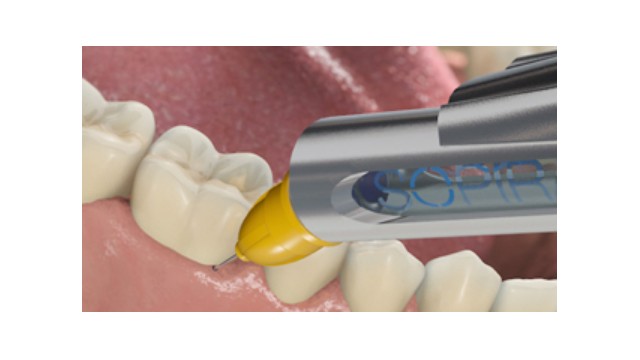 Intraligamentary Anaesthesia