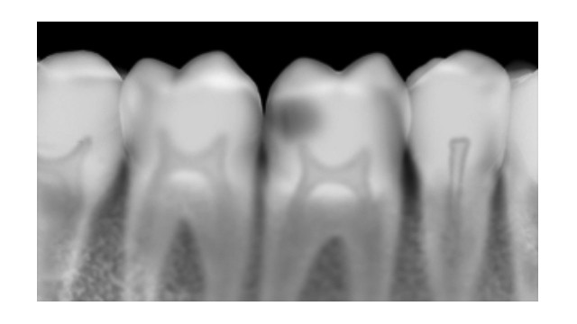 X-Ray Materials