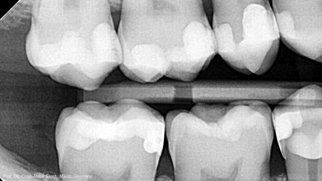 Radiografie de control