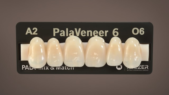 kulzer_pala_veneer_6_A2