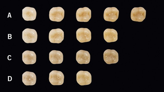 Cavity teeth A1-D4 occlusally filled with Venus Bulk Flow ONE.