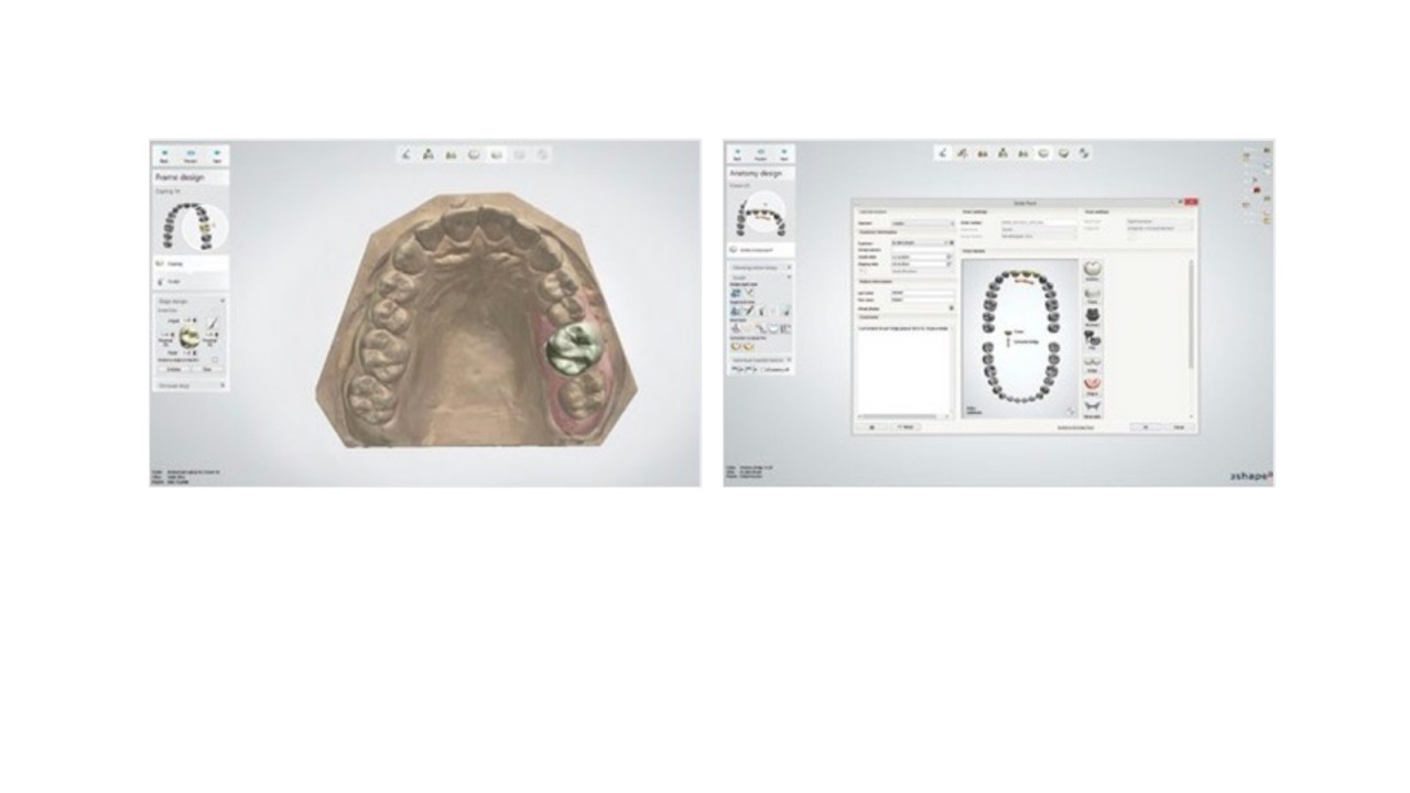 3Shape Dental System