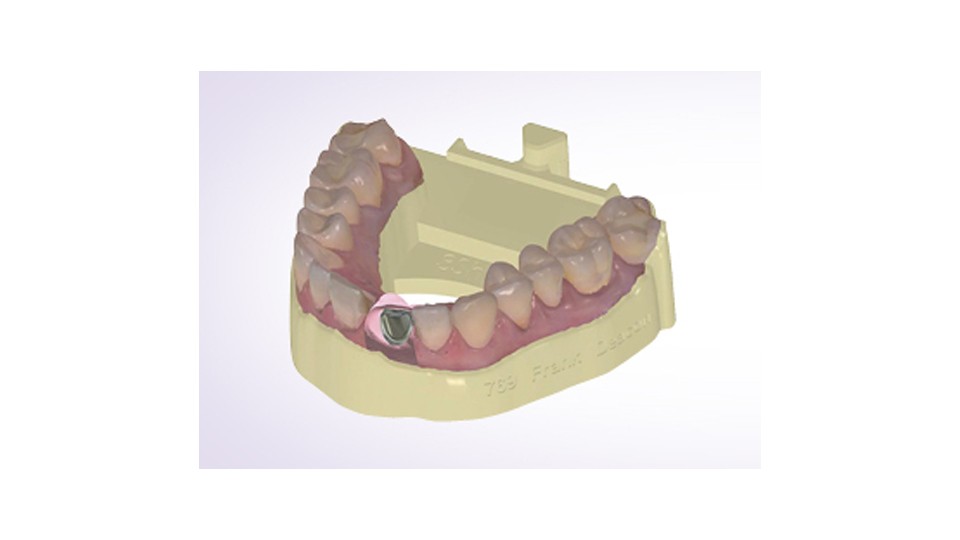 3Shape Dental System