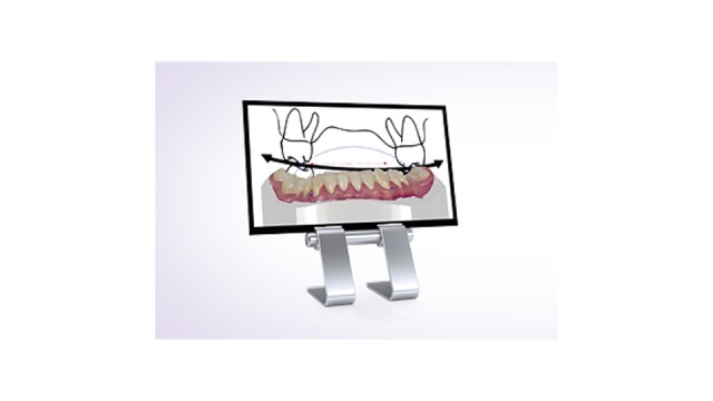 Ortho Analyzer™