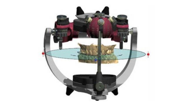 Virtual articulator