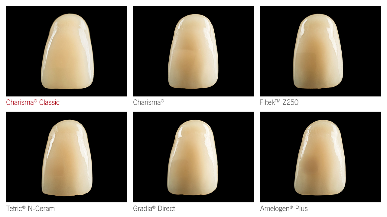 Ideal colour match of Charisma Classic due to the Microglass II effect