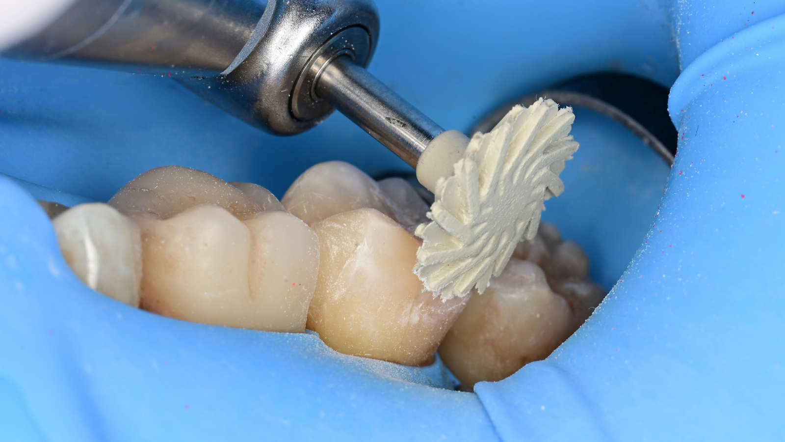 Buccal