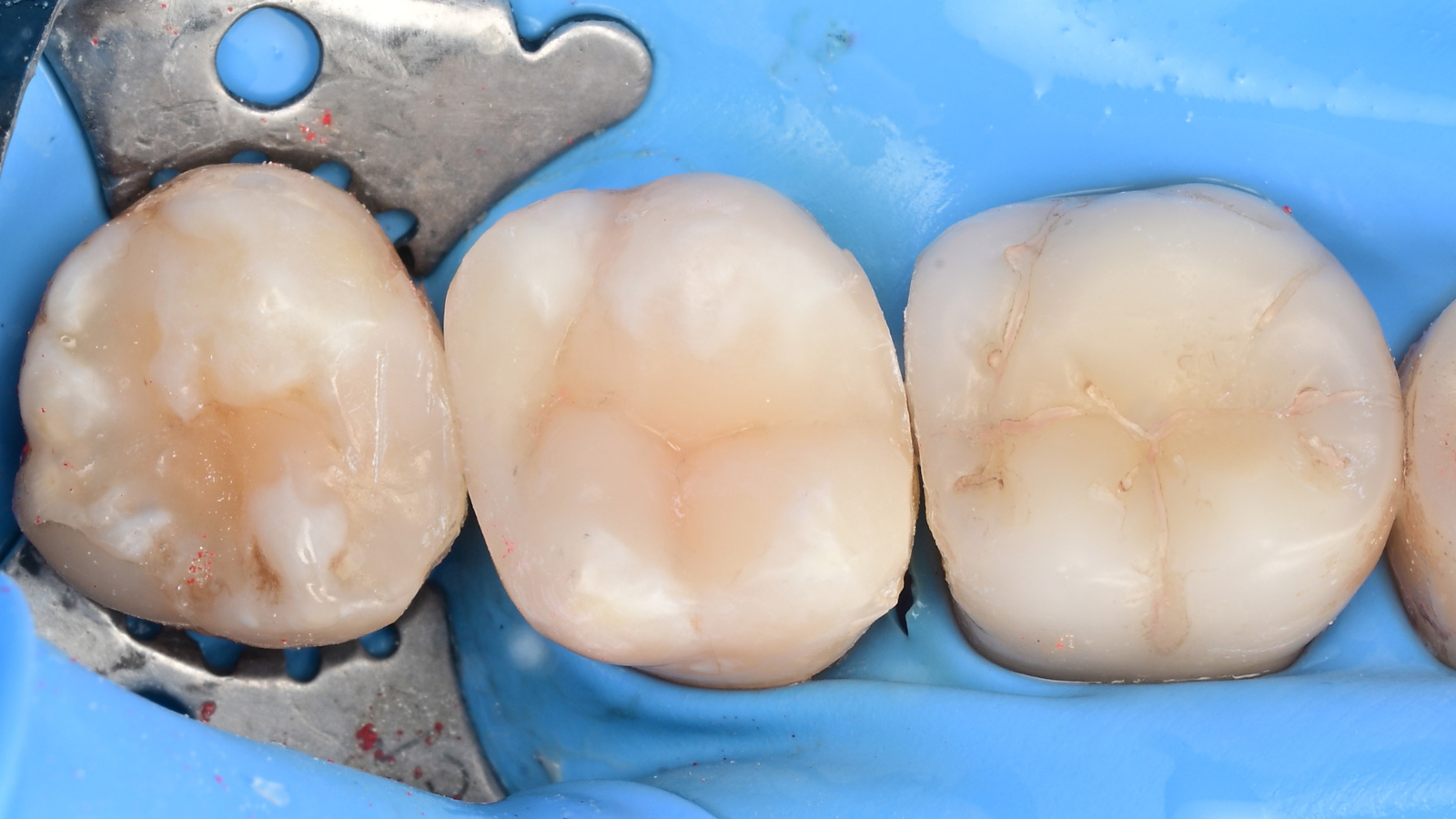 Case 2