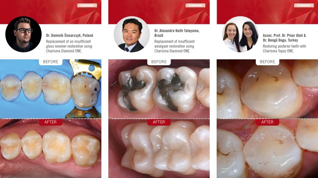 Before & After Cases