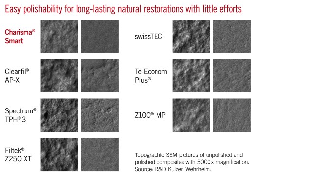 Charisma Smart - Easy polishability for long-lasting natural restorations with little efforts