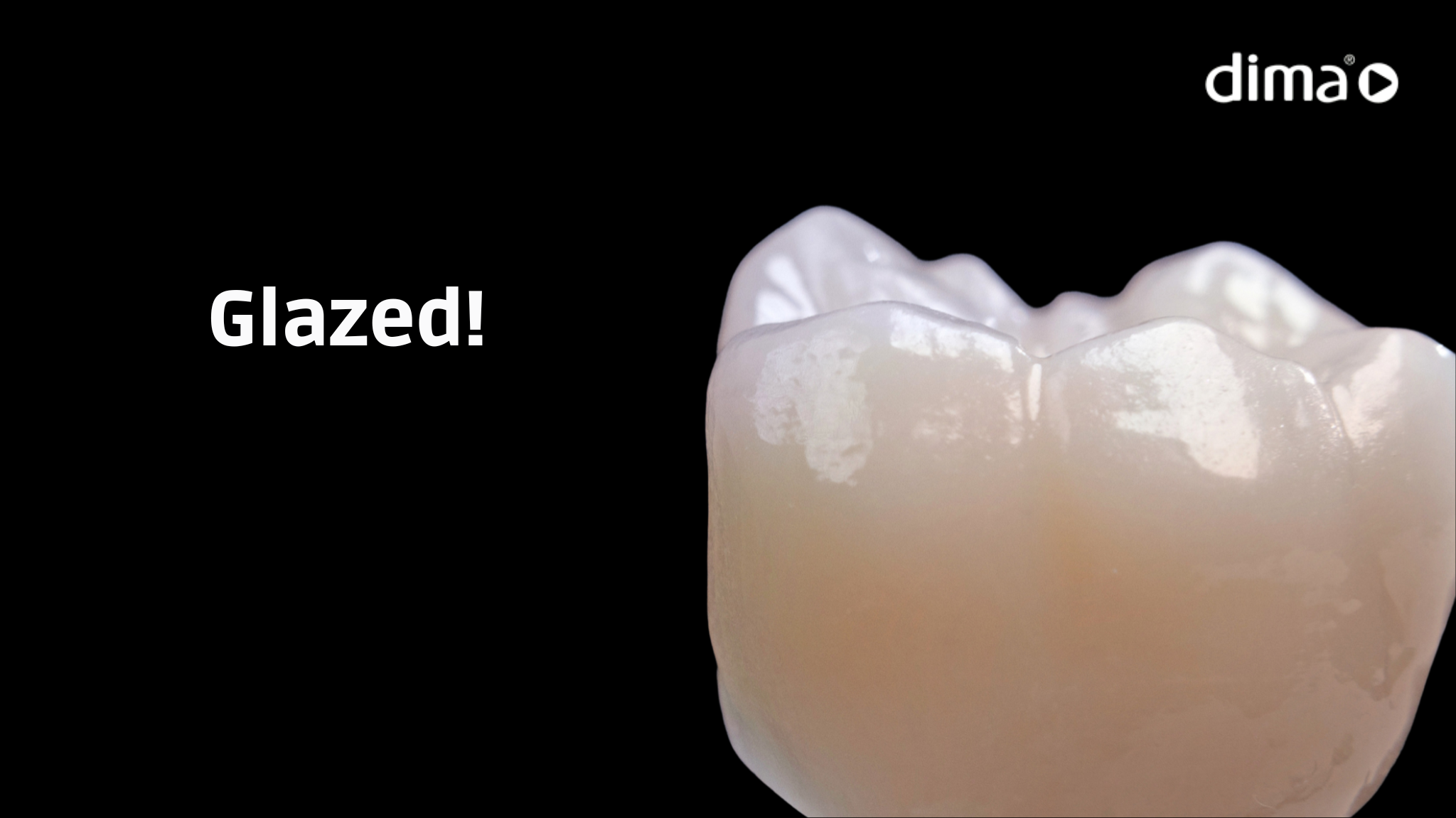 dima mill zirconia multi-glazed crown