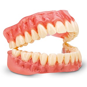 Dima Print digital denture