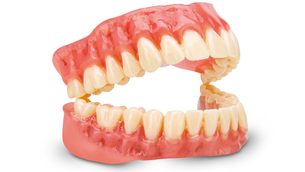 dima Print Denture – Resin for 3D printed dentures