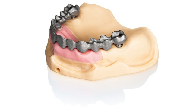 3D implant models with gingiva masks