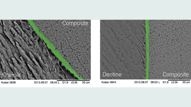 GLUMA Bond5 layer