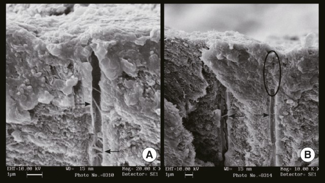 Longitudinal sections of a specimen