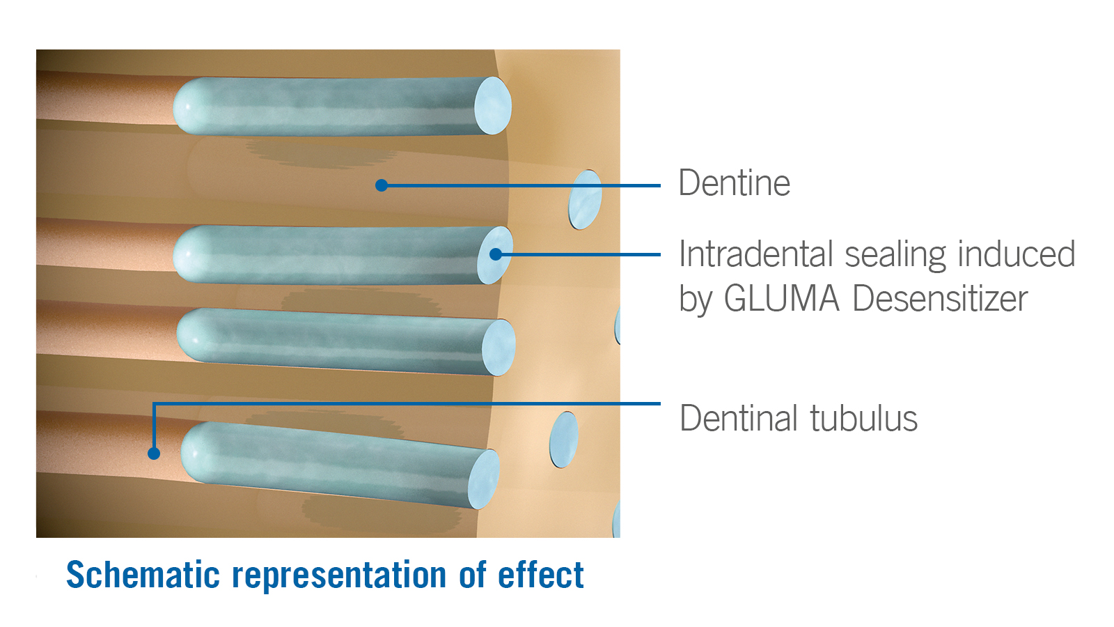 Schematic representation of effect