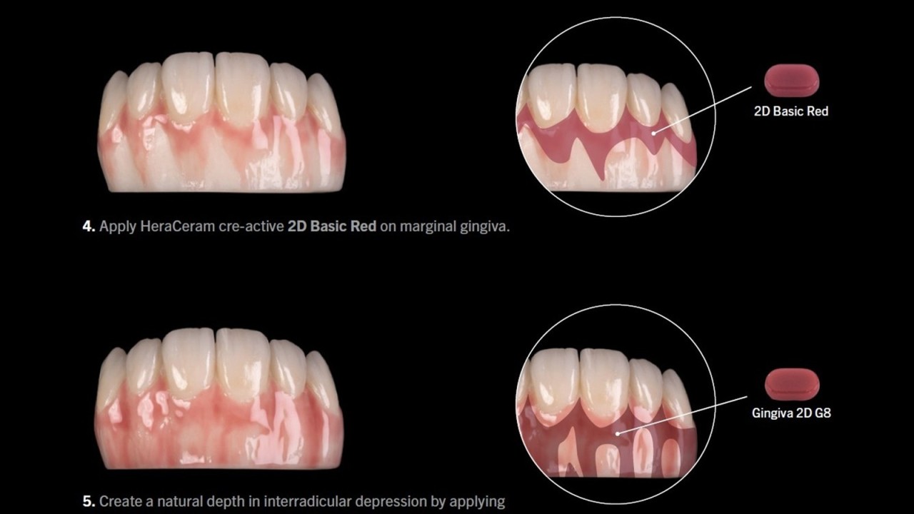 Pink & White Aesthetic Finishing