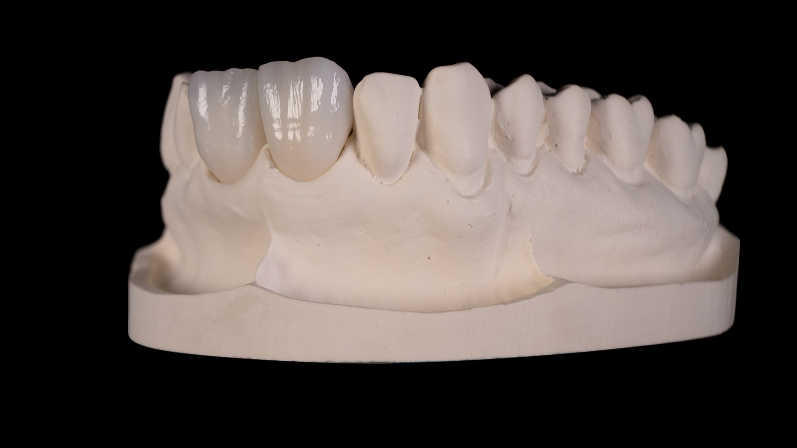 Final result after HeraCeram cre-active 2D Firing