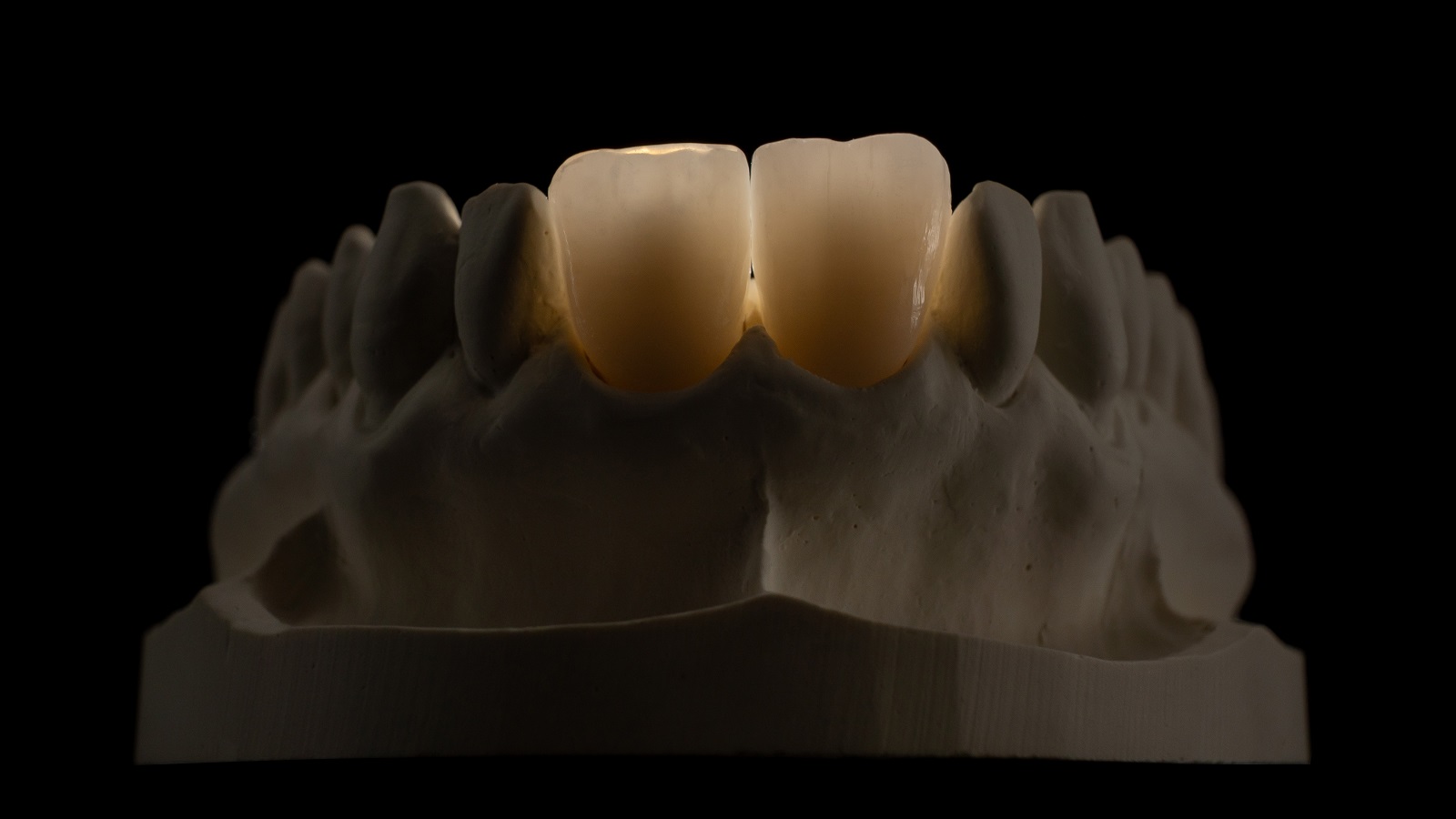 HeraCeram cre-active - Bleach please concept