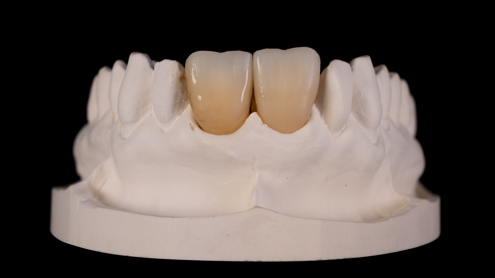 Strengthening chroma in cervical area: