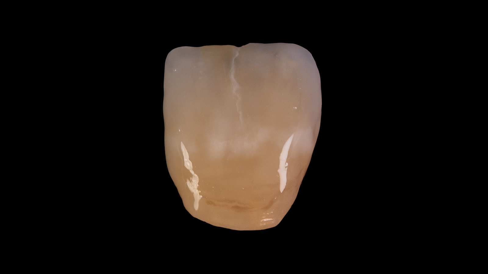 HeraCeram cre-active - Magic matrix concept