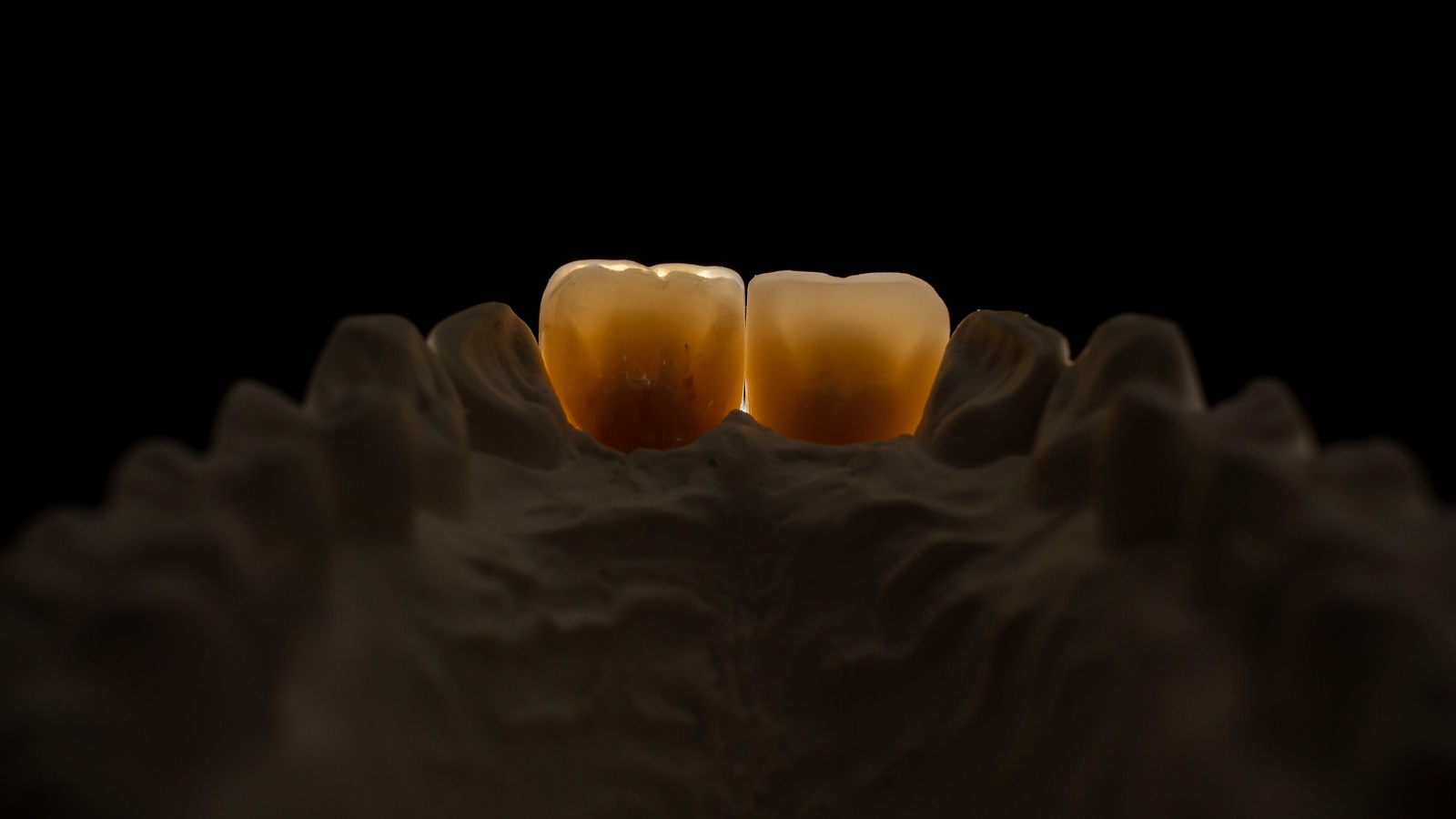 Final result in transmitted light from palatinal