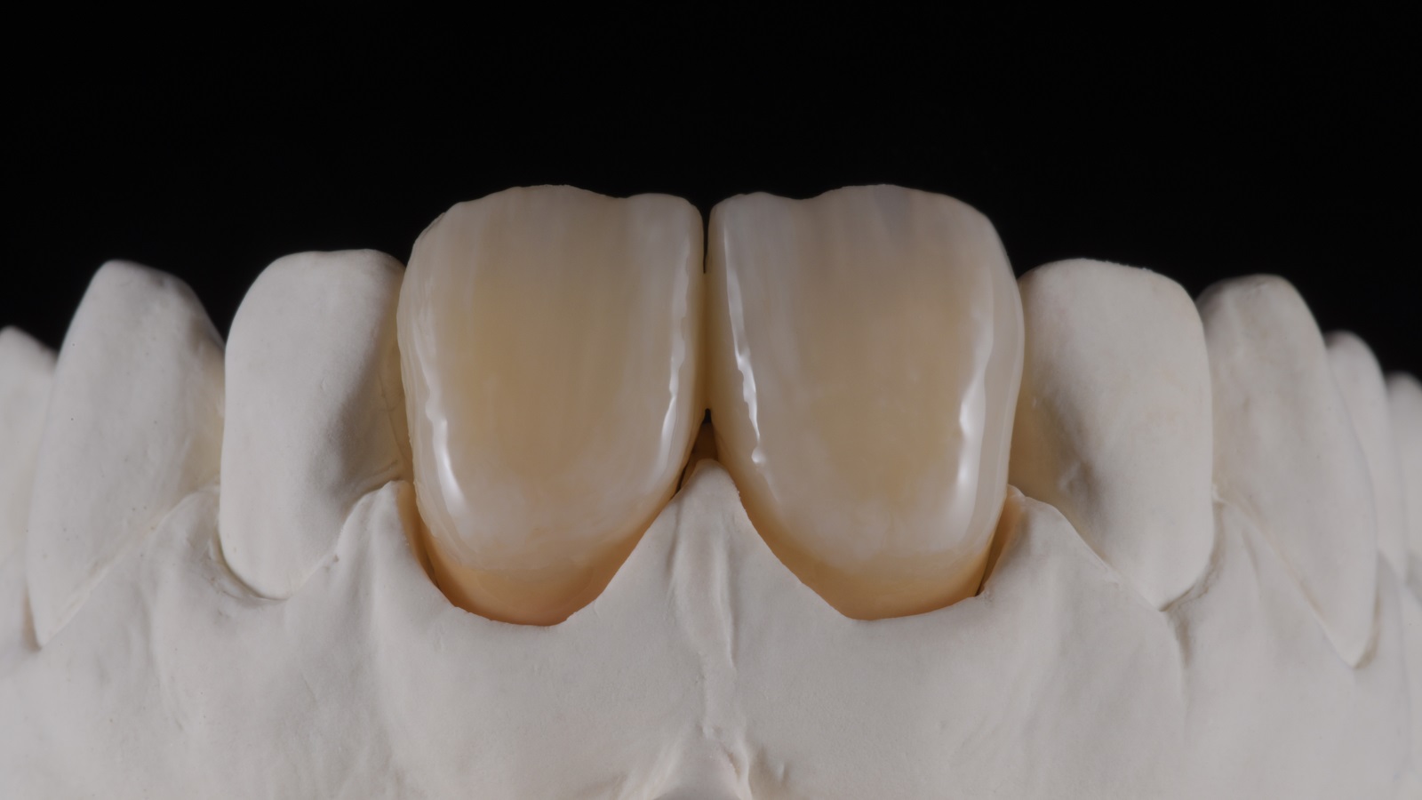 HeraCeram cre-active - take two concept