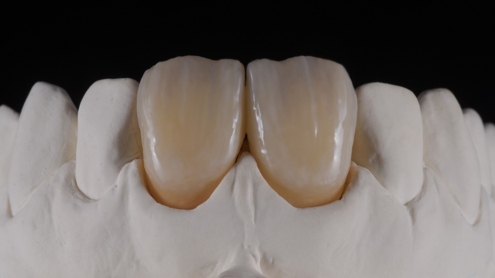 HeraCeram cre-active - take two concept