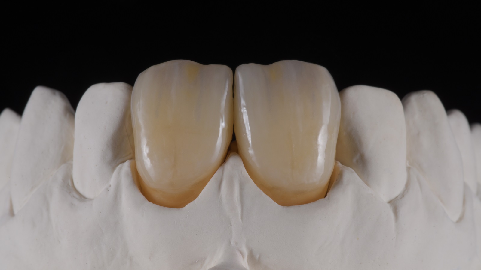 HeraCeram cre-active - take two concept