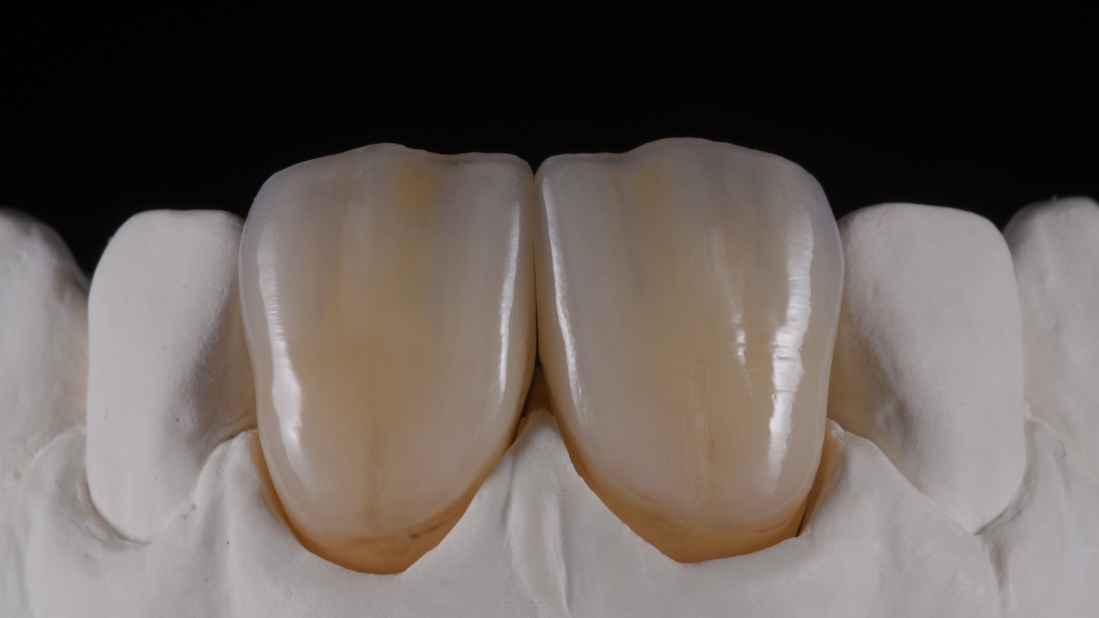 HeraCeram cre-active - take two concept