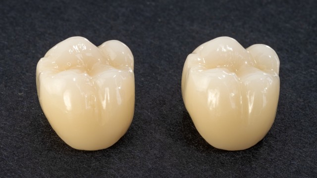 Crowns in normal light conditions