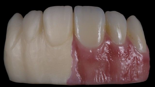 Before-after case