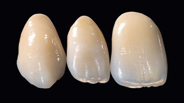 HeraCeram Saphir