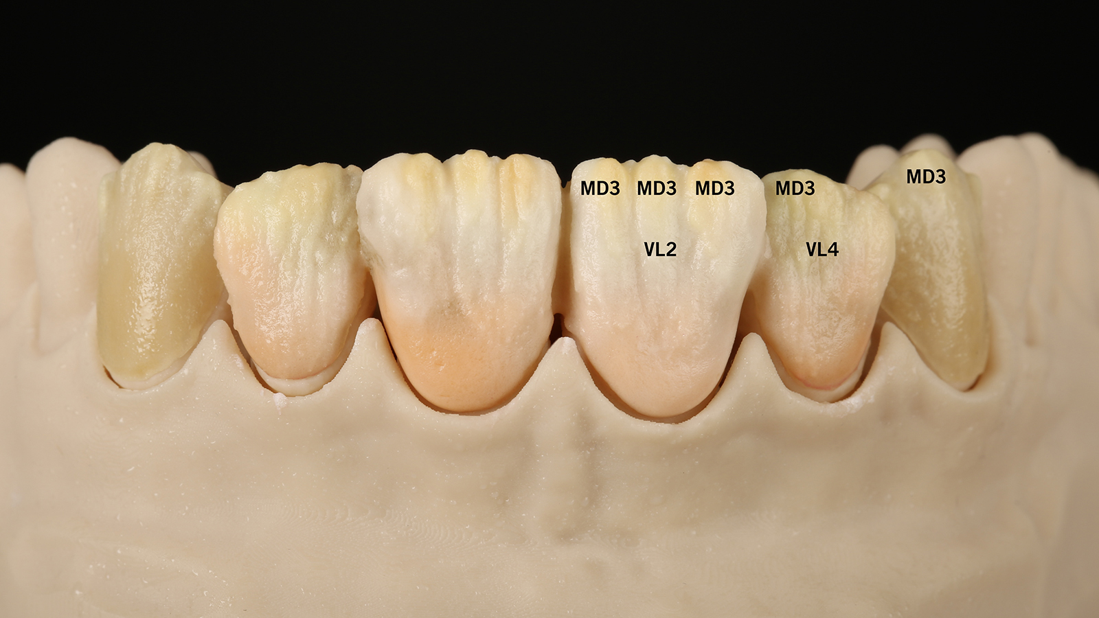 Apply VL 2, VL 4, MD 3