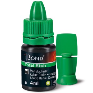 iBond Total Etch Recommendation
