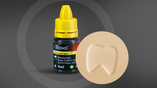 iBOND Universal