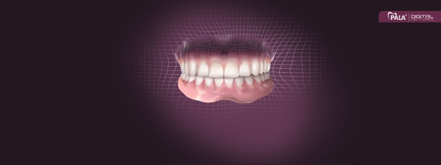 PALA Digital Dentures 