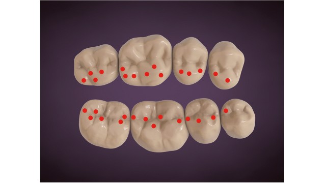 Occlusion model 3