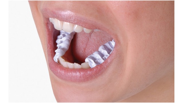 Standard bite registration in the final occlusal position