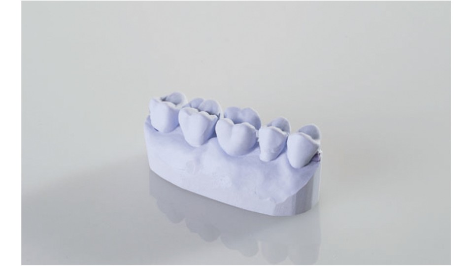 Variotime Bite Bite registration