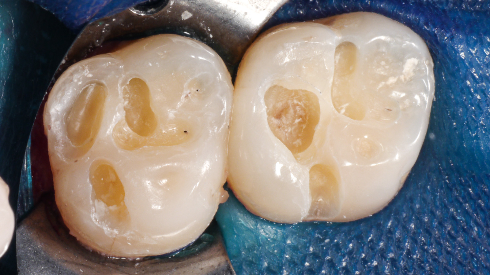 Click and hold the green slider. Move from side to side to reveal the before-and-after pictures.