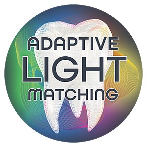 Adaptive Light Matching